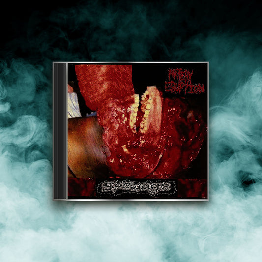Artery Eruption - Spewage (CD)
