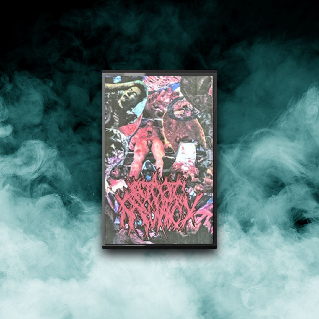 Ectopic Pregnancy - S/T 2024 EP (Tape)