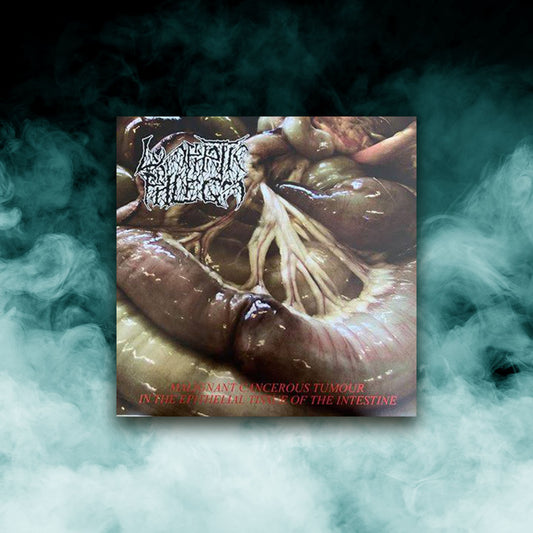 Flesh Grinder / Lymphatic Phelgm - Split (12" Vinyl)