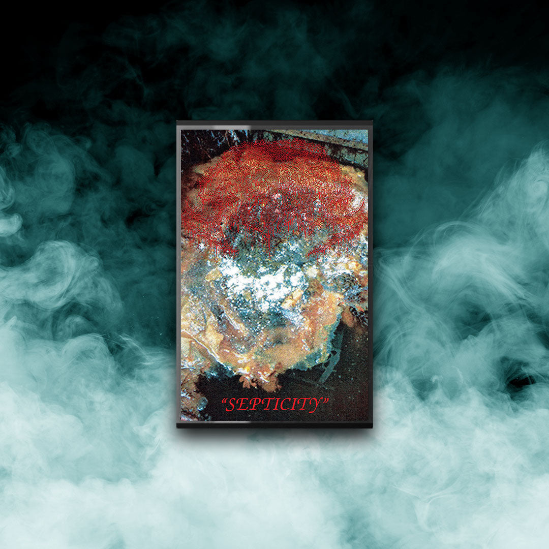 Fosse Septique - Septicity (Tape)