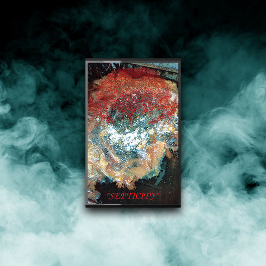 Fosse Septique - Septicity (Tape)