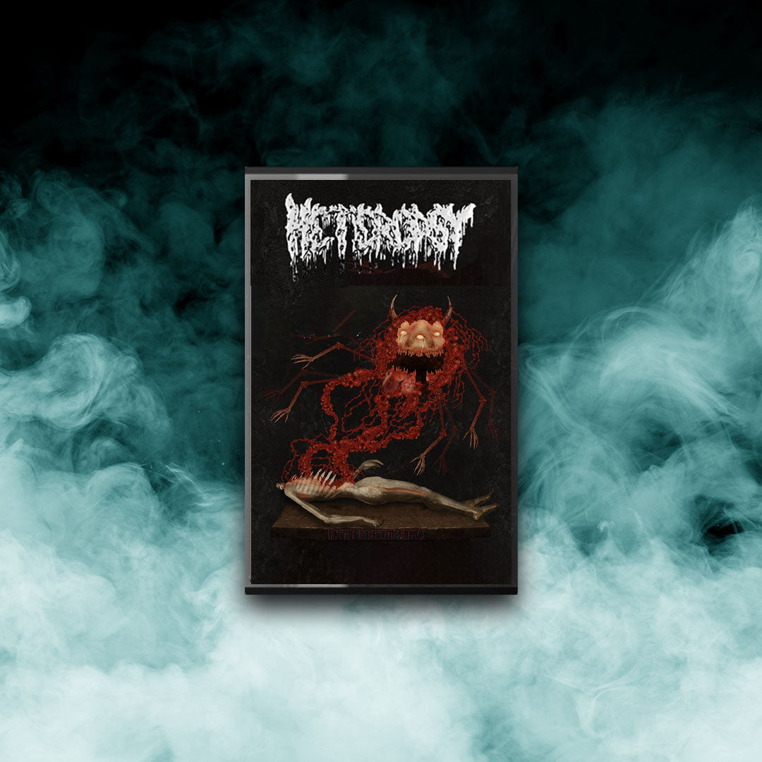 Heteropsy - Embalming (Tape)