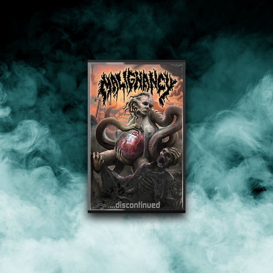 Malignancy - Discontinued (Tape)
