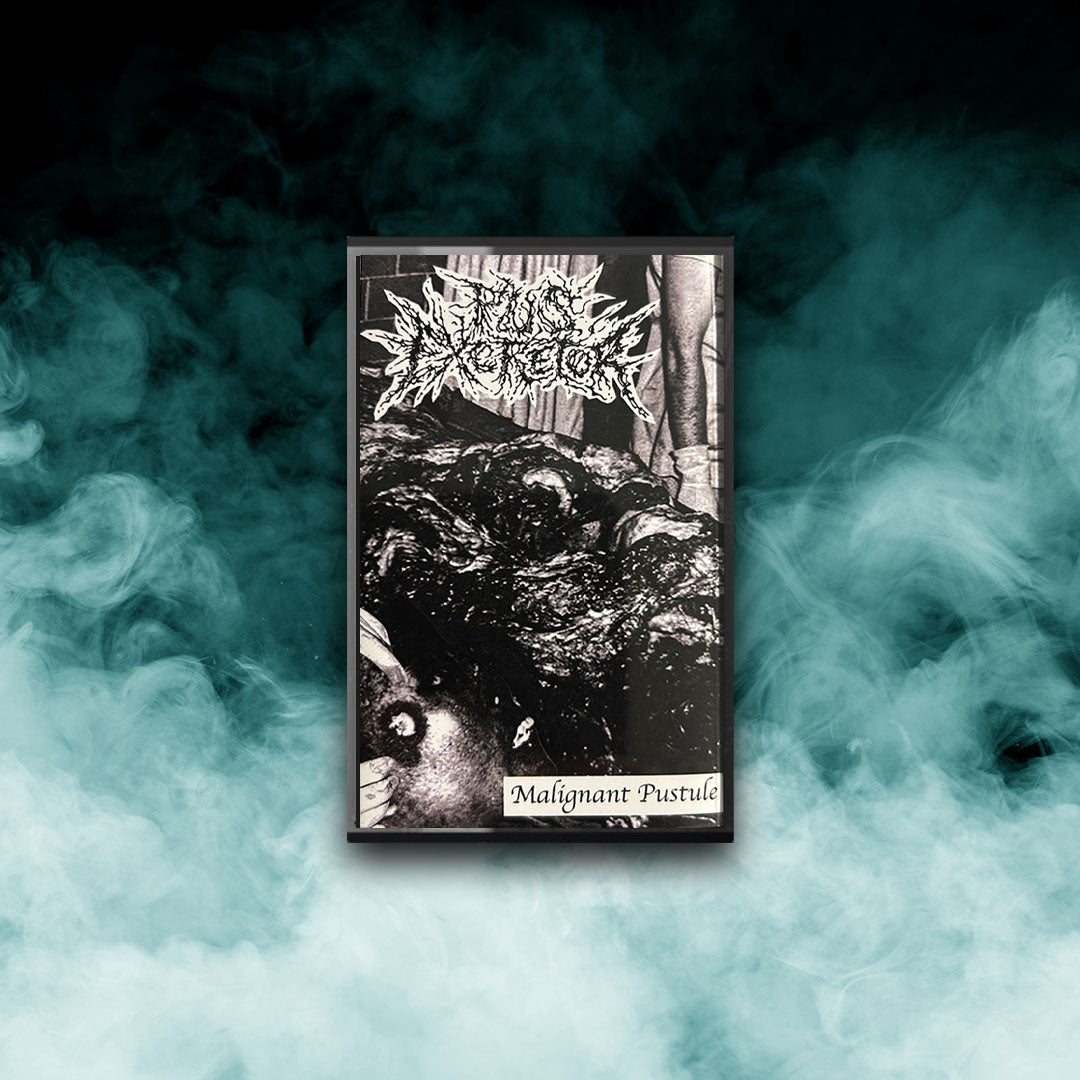 Pus Excretor - Malignant Pustule (Tape)