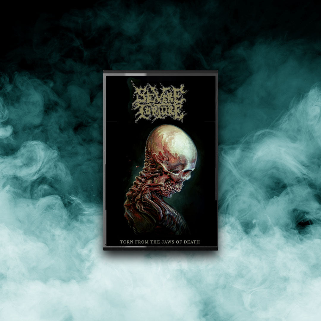 Severe Torture - Torn From the Jaws of Death (Tape)