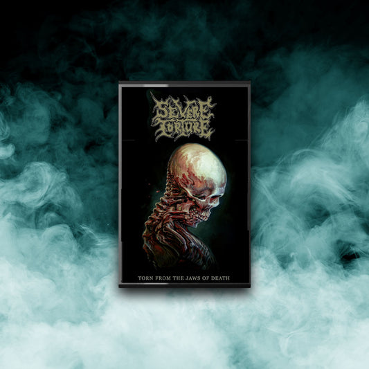 Severe Torture - Torn From the Jaws of Death (Tape)