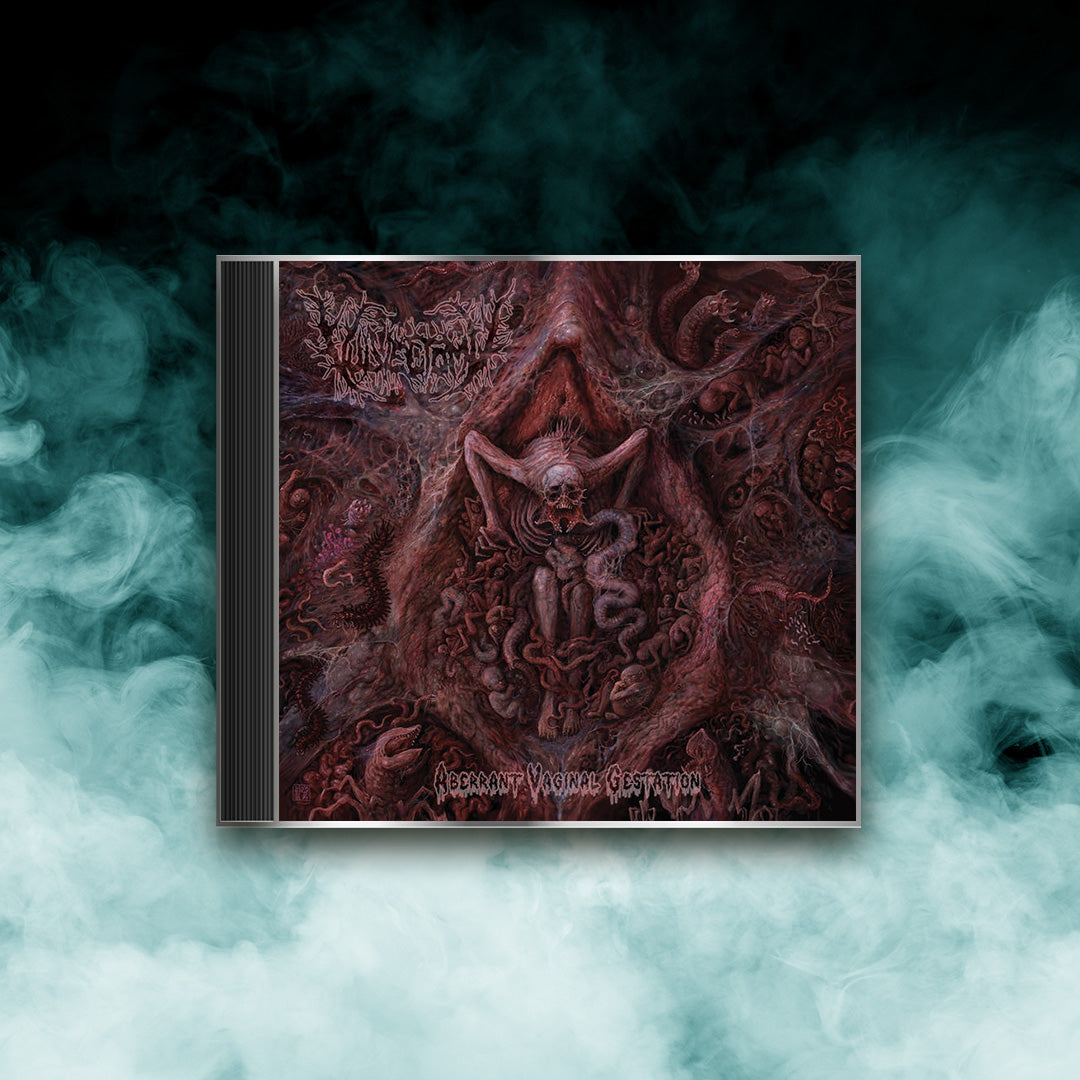 Vulvectomy - Aberrant Vaginal Gestation (CD)