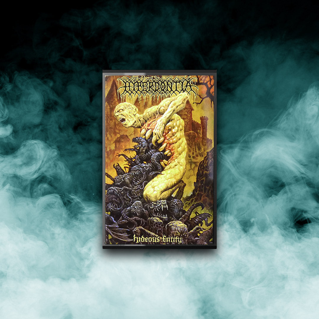 Hyperdontia - Hideous Entity (Tape)
