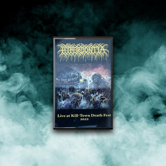 Hyperdontia - Live at Killtown (Tape)