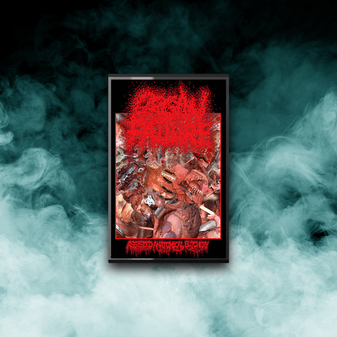 Organ Failure - Assisted Anatomical Butchery (Tape)