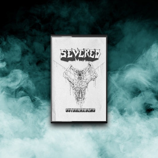 Severed	- Outbreak Demo (Tape)