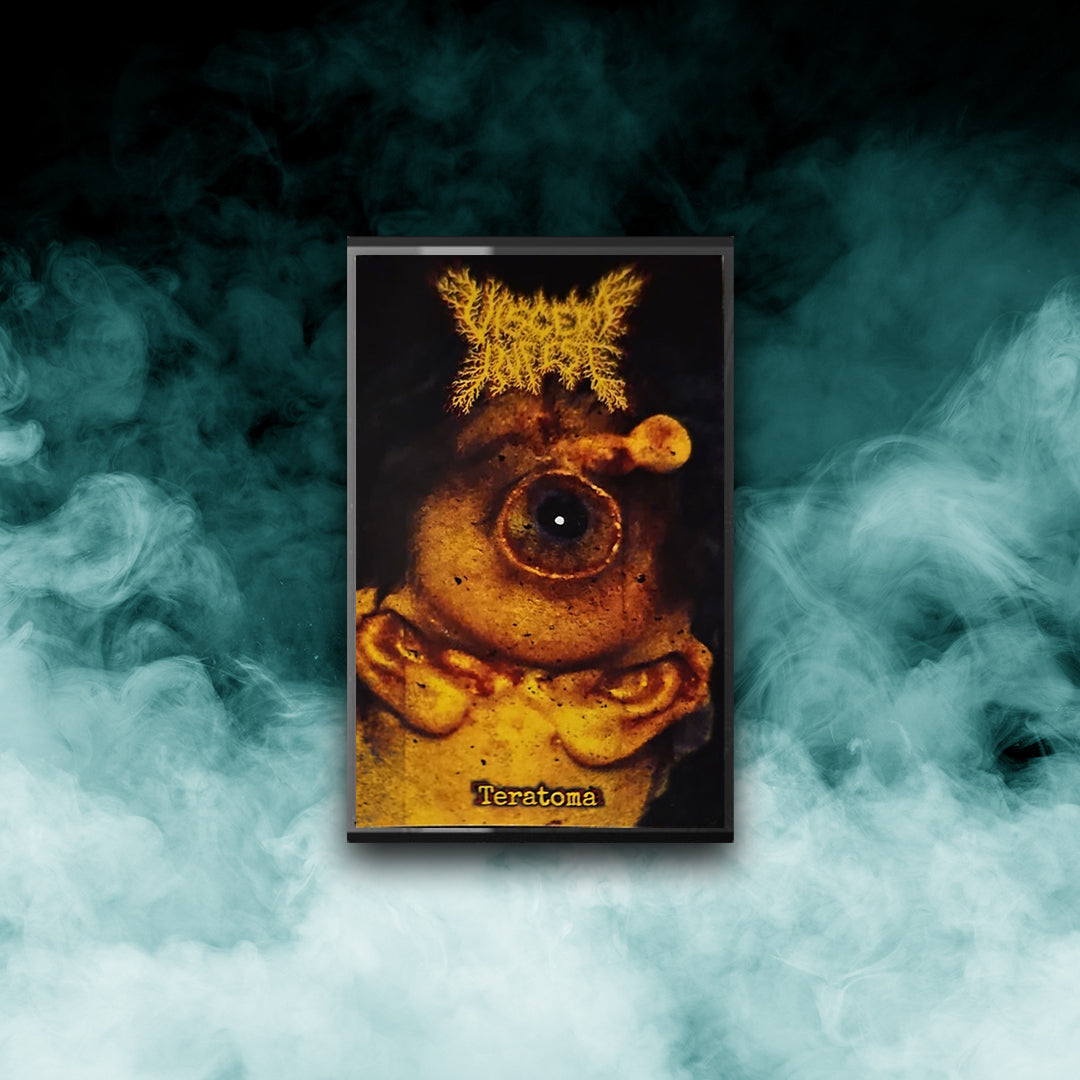 Viscera Infest - Teratoma (Tape)